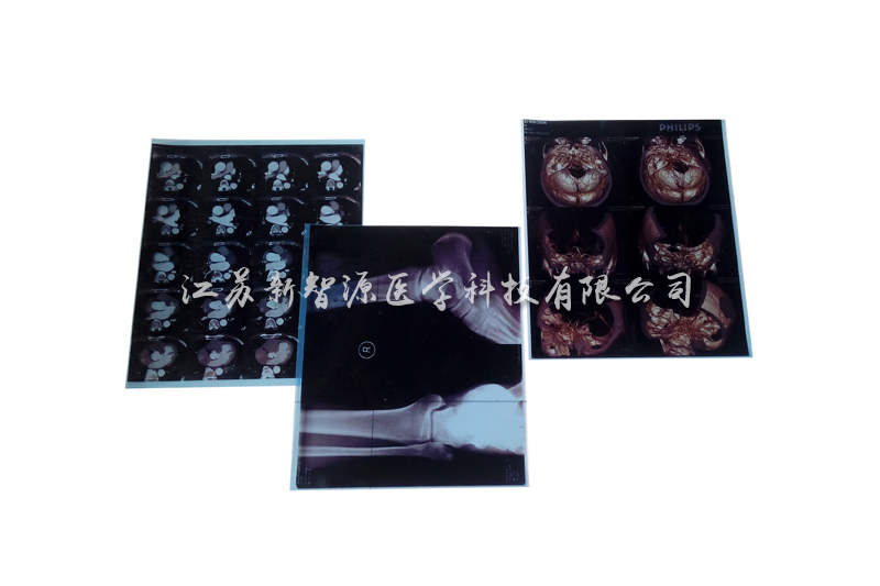 Medical printing film